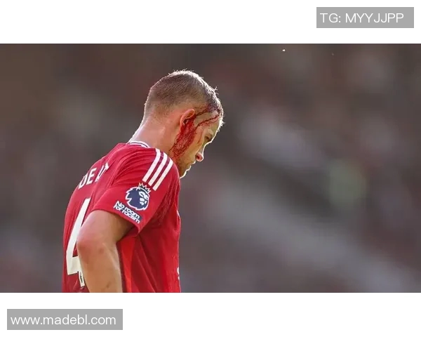 曼联女足球员埃拉图恩带领红魔闪耀英超赛场成就传奇 曼联女足球员埃拉图恩带领红魔闪耀英超赛场成就传奇